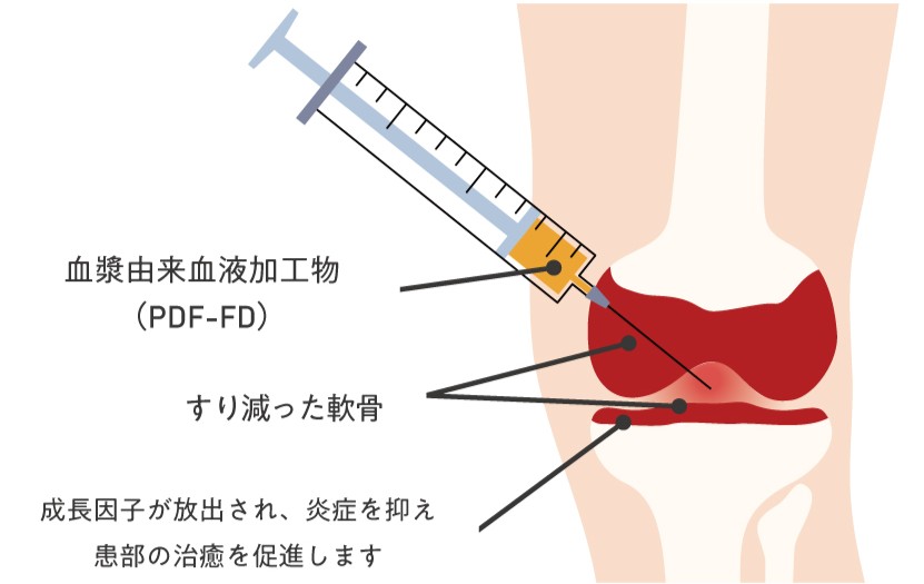 再生医療とは？