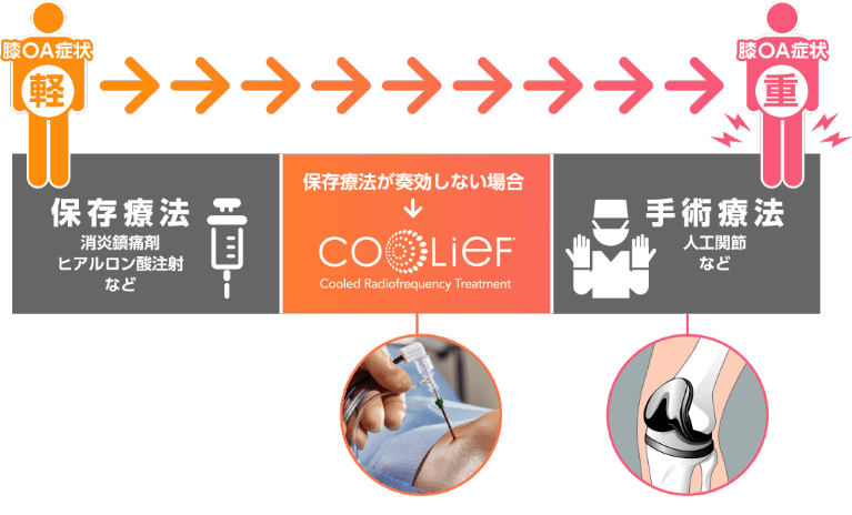 Coolief_治療の選択肢
